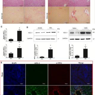 Knockdown Of Astrocyte Elevated Gene Aeg Inhibits Proliferation