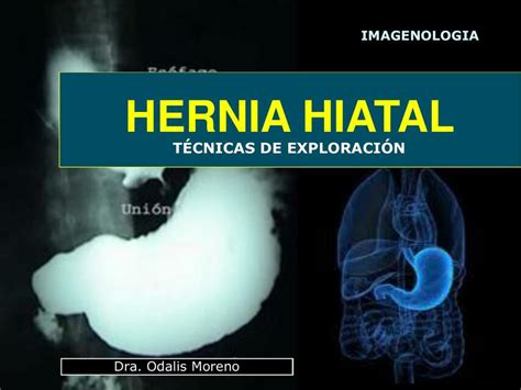 📸hernia Hiatal Técnicas De Exploración Imagenología🩻 Dra Odalis