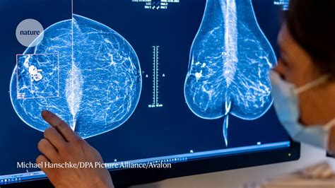 Huge Leap In Breast Cancer Survival Rate