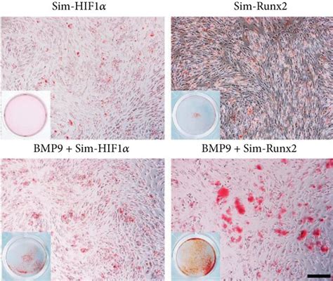 Silencing Hif1α And Runx2 Effectively Diminishes The Bmp9 Induced Early