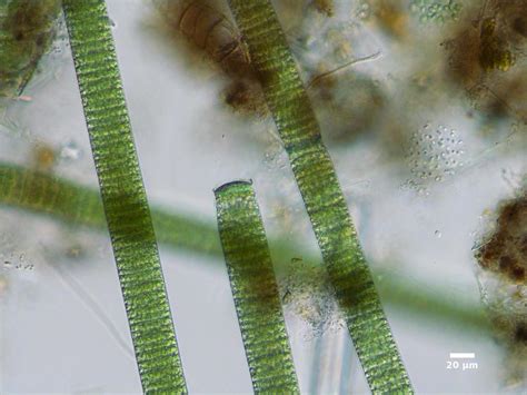 Oscillatoria Under A Microscope