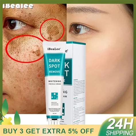 Freckle Cream Whitening Remove Chloasma Dark Spots Melanin Brightening