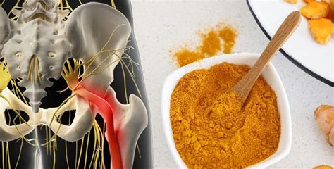 The Exact Method For Taking Turmeric To Help Relieve Sciatica Pain