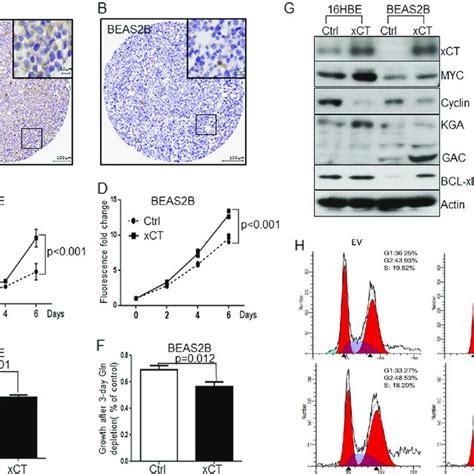 Overexpression Of XCT Promotes The Proliferation And Glutamine