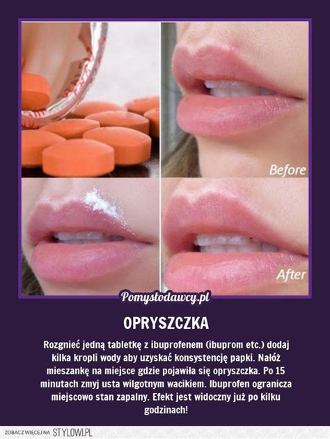 PROSTY SPOSÓB NA OPRYSZCZKĘ, KTÓREGO NIE ZNASZ! na Stylowi.pl | Healthy ...