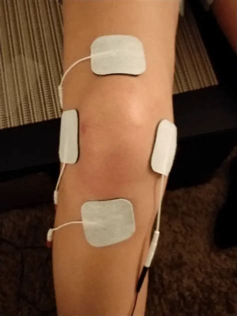 How To Correctly Use A Tens Unit Placement For Your Knee Pain