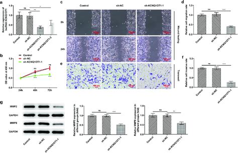 Silenced Kcnq1ot1 Suppressed Cell Proliferation Migration And Invasion