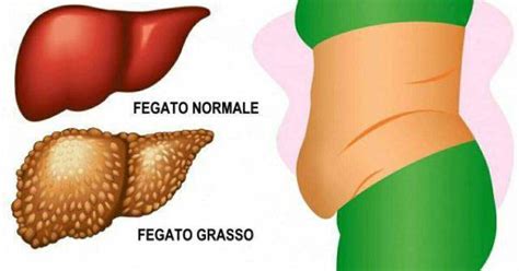 L Alimentazione Per Il Fegato Grasso Dott Federico Zanga