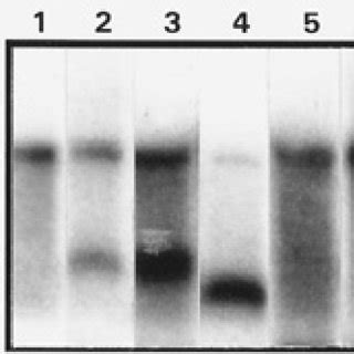 Northern blot hybridization of a total RNA extract from infected Datura ...