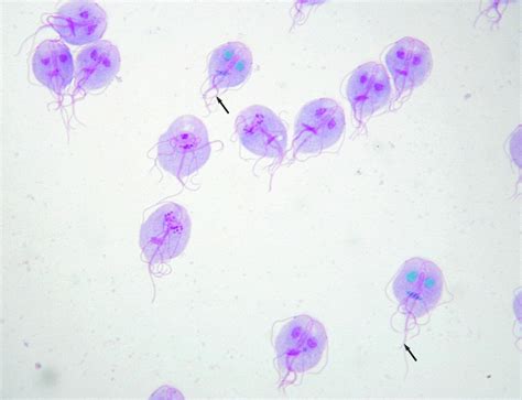 Giardia Cyst In Fecal Float