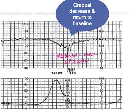 Intrapartum Surveillance And Abnormalities Flashcards Quizlet