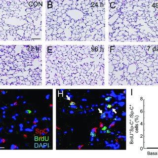 Morphology And Cell Proliferation After PA Induced Lung Injury A F