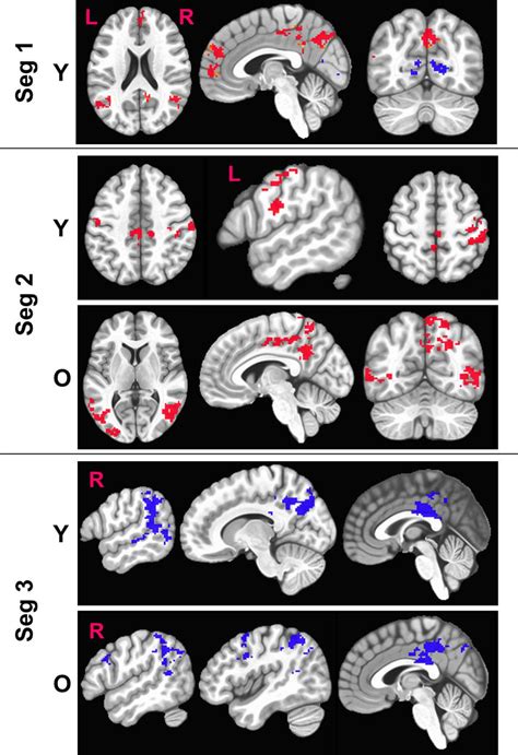 Frontiers Correcting Task Fmri Signals For Variability In Baseline