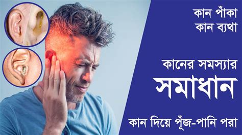 যদি কানে তীব্র ব্যথা হয় এবং কান দিয়ে পুঁজ বা পানি পরে থাকে তাহলে কি