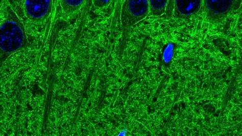 Expansion Microscopy Imaging Of Actin Filaments In The Mouse