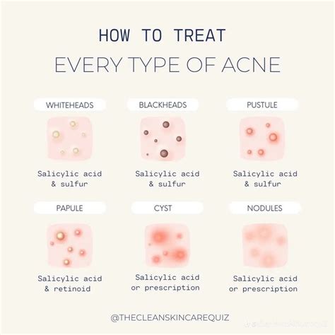 Types of acne | Beauty treatments skin care, Forehead acne, Skin facts