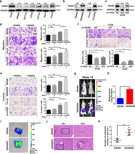 Rank Promoted The Metastasis Of Crc Cells In Vitro And In Vivo A