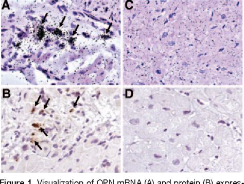 Figure From Osteopontin A Fibrosis Related Marker Molecule In