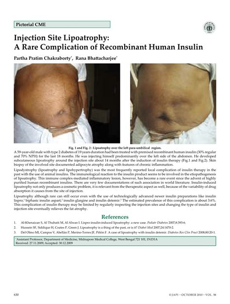 (PDF) Injection site lipoatrophy: a rare complication of recombinant ...