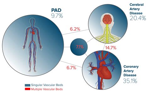 Peripheral Artery Disease Pathophysiology