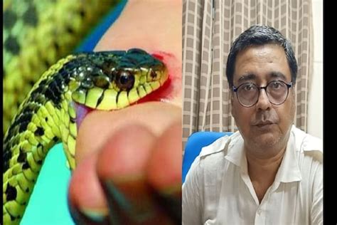 Snake Bite Treatment কেউটে না গোখরো কোন সাপ কামড়েছে বুঝবেন কী করে কী