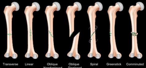 MSK Radiology Flashcards Quizlet