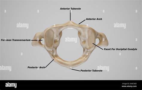 Axis And Atlas Vertebrae Labeled