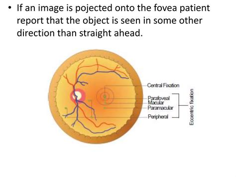 Amblyopia | PPT