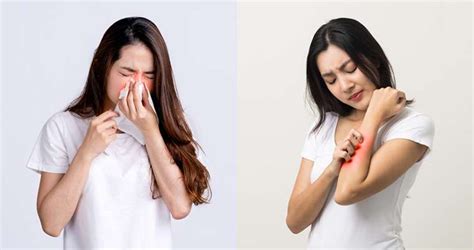 Understanding Allergy Types Symptoms And Treatment