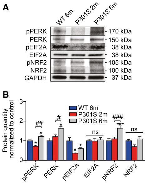 Perk Activation Mitigates Tau Pathology In Vitro And In Vivo Embo