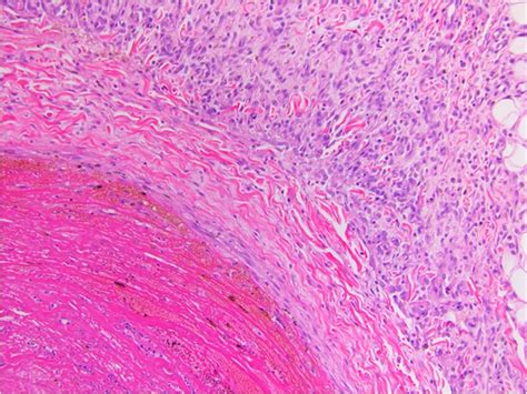 Histological Cross Section Of Jugular Vein Of Rabbit Implanted With