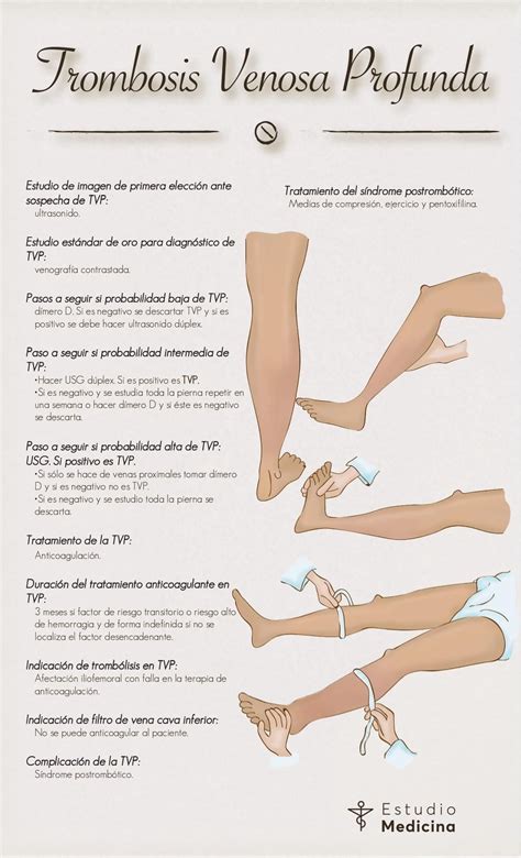 Maniobras Semiologicas Para Trombosis Venosa Profunda Tu Estilo The