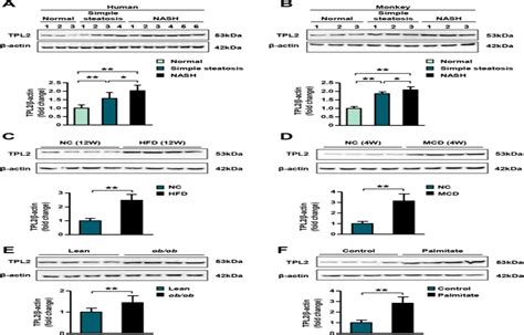 Tumor Progression Locus In Hepatocytes Potentiates Both Li