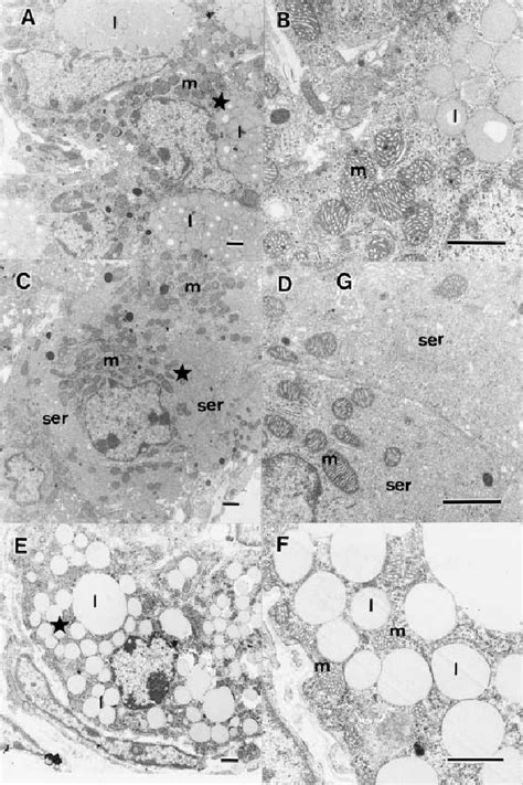 Ultrastructure Of The Luteinized Interstitial Cells The Ovarian