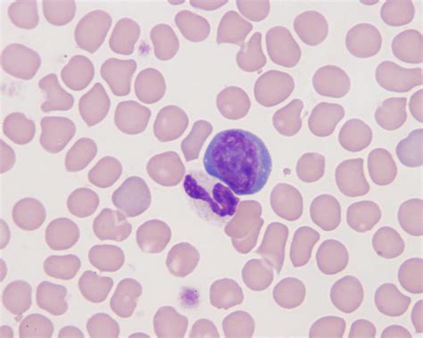 Canine Blood Eclinpath