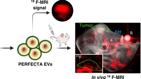 19f 磁共振成像用于外泌体示踪 哔哩哔哩