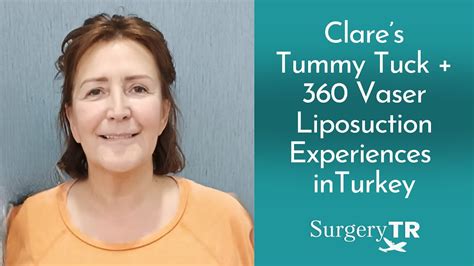 Tummy Tuck Vaser Liposuction Clare S Experiences Surgerytr