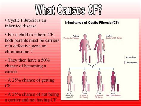 Cystic Fibrosis