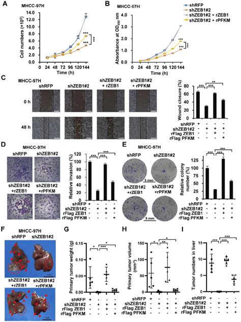 Pfkm Plays A Key Role In Zeb1 Stimulated Tumorigenesis And Intrahepatic