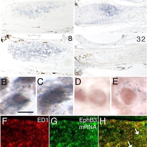 Expression Of EphB3 By Macrophages A In Situ Hybridization Detection