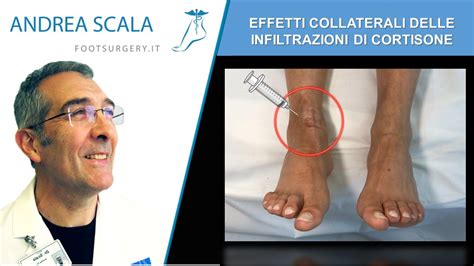 Effetti Collaterali Delle Infiltrazioni Di Cortisone In Ortopedia