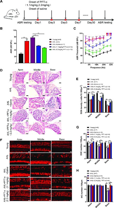 p53 inhibitor pifithrin α rescues the hearing loss in AHL mice A