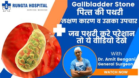 Gall Bladder Stone Symptoms Treatment In Hindi Gallstone In Hindi