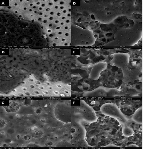 Photomicrographs Obtained By Scanning Electron Microscopy SEM Of The