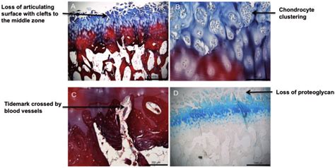 Intact And Degraded Cartilage Bone Interface Osteochondral Unit A