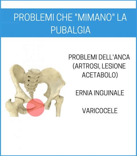 Curare La Pubalgia In 3 Step Esercizi E Rimedi Che Funzionano