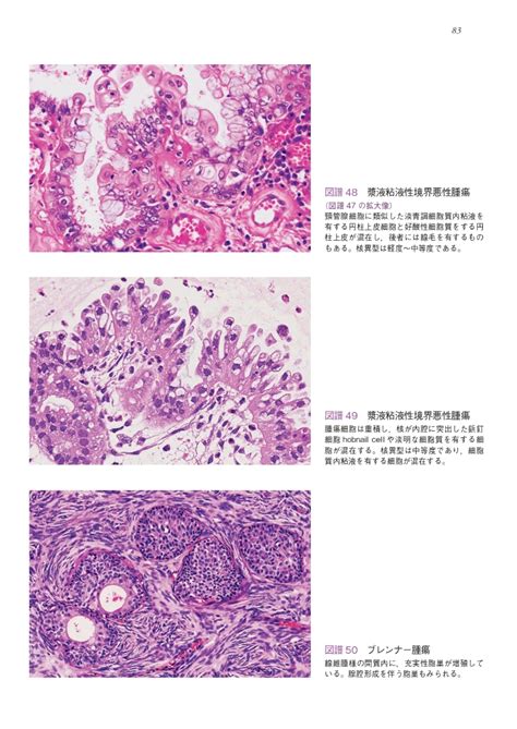 楽天ブックス 卵巣腫瘍・卵管癌・腹膜癌取扱い規約 病理編 第2版 日本産科婦人科学会 9784307301534 本