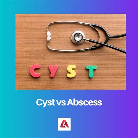 Cyst vs Abscess: Difference and Comparison