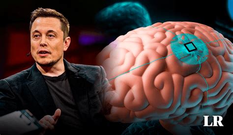 Elon Musk Anuncia Primer Implante Cerebral De Neurolink En Humanos