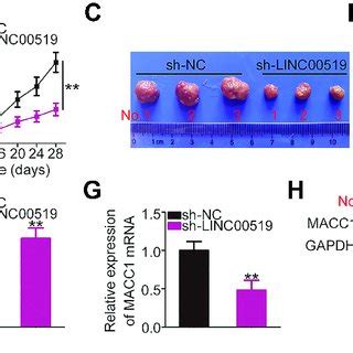 Long Intergenic Non Coding Rna Linc Promotes Tongue Squamous